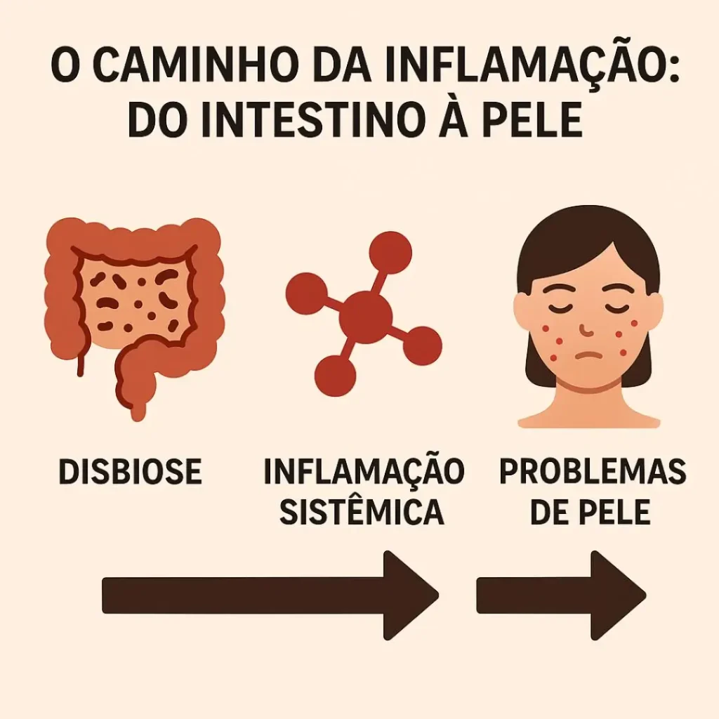 Infográfico explicando como a disbiose afeta a pele através da inflamação sistêmica